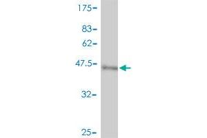 Western Blot detection against Immunogen (44. (NME3 antibody  (AA 1-169))