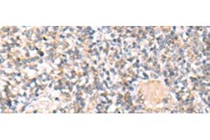 Immunohistochemistry of paraffin-embedded Human tonsil tissue using IL36A Polyclonal Antibody at dilution of 1:30(x200) (IL36A/IL1F6 antibody)