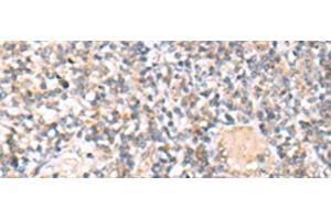 Immunohistochemistry of paraffin-embedded Human tonsil tissue using IL36A Polyclonal Antibody at dilution of 1:30(x200) (IL36A/IL1F6 antibody)