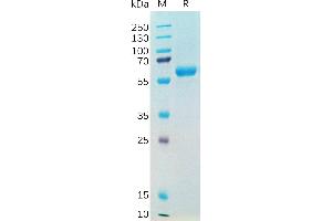 SDS-PAGE (SDS) image for SARS-CoV-2 Spike (B.1.1.7 - alpha), (RBD) protein (Fc Tag) (ABIN7490638)