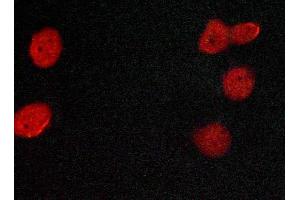 ABIN6269080 staining MCF-7 cells by ICC/IF. (Estrogen Receptor alpha antibody  (C-Term))