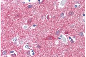 Human Brain, Cortex (formalin-fixed, paraffin-embedded) stained with CNR1 antibody ABIN337042 at 5 ug/ml followed by biotinylated goat anti-rabbit IgG secondary antibody ABIN481713, alkaline phosphatase-streptavidin and chromogen. (CNR1 antibody  (AA 1-99))
