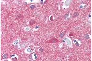 Human Brain, Cortex (formalin-fixed, paraffin-embedded) stained with CNR1 antibody ABIN337042 at 5 ug/ml followed by biotinylated goat anti-rabbit IgG secondary antibody ABIN481713, alkaline phosphatase-streptavidin and chromogen.