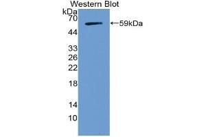 Detection of Recombinant NOTCH3, Human using Polyclonal Antibody to Notch Homolog 3 (NOTCH3) (NOTCH3 antibody  (AA 2053-2318))