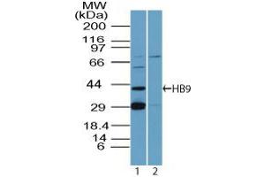 MNX1 antibody  (AA 330-380)