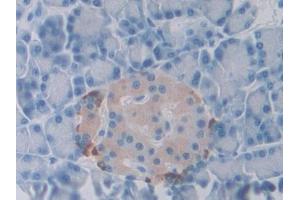 DAB staining on IHC-P; Samples: Rat Pancreas Tissue (SLIT1 antibody  (AA 611-791))