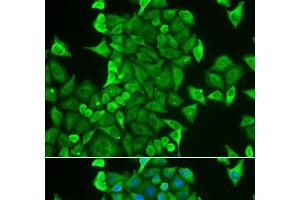 Immunofluorescence analysis of HeLa cells using CARS Polyclonal Antibody (CARS antibody)