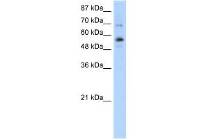 WB Suggested Anti-ZNF71 Antibody Titration:  0.