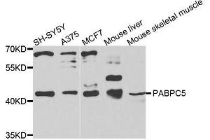 Western blot analysis of extracts of various cell lines, using PABPC5 antibody (ABIN6003706) at 1/1000 dilution. (PABPC5 antibody)