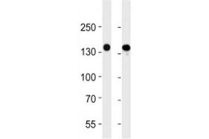 VEGFR3 antibody western blot analysis in 293 and A549 lysate. (FLT4 antibody)