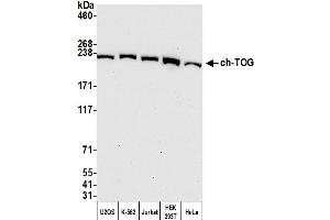 Western Blotting (WB) image for anti-Cytoskeleton Associated Protein 5 (CKAP5) (AA 1425-1475) antibody (ABIN7450110)
