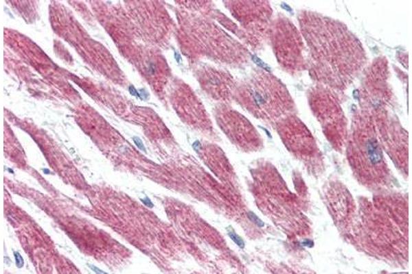 GPR15 antibody  (Extracellular Domain)