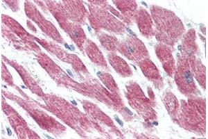 Anti-GPR15 antibody  ABIN1048732 IHC staining of human heart. (GPR15 antibody  (Extracellular Domain))