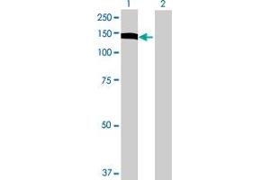 Western Blot analysis of UTP14A expression in transfected 293T cell line by UTP14A MaxPab polyclonal antibody.