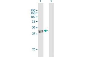 Western Blot analysis of PDSS2 expression in transfected 293T cell line by PDSS2 MaxPab polyclonal antibody. (PDSS2 antibody  (AA 1-399))