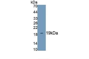 Detection of Recombinant LPCAT3, Mouse using Polyclonal Antibody to Lysophosphatidylcholine Acyltransferase 3 (LPCAT3) (LPCAT3 antibody)