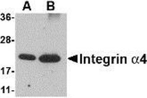 Western blot analysis of Integrin alpha 4 using (A) 25 and (B) 100 ng of recombinant Integrin alpha 4 with AP30435PU-N Integrin alpha 4 antibody at 1 μg/ml. (ITGA4 antibody  (Center))