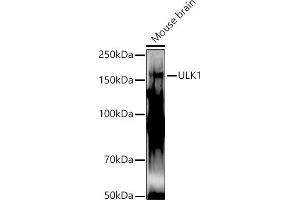 ULK1 antibody  (AA 400-499)