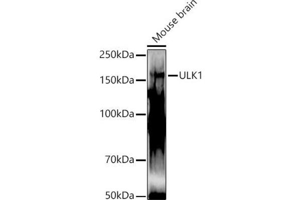 ULK1 antibody  (AA 400-499)