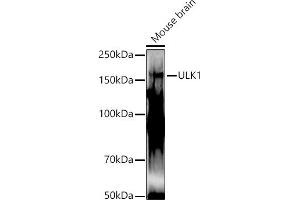 Western blot analysis of extracts of Mouse brain, using ULK1 antibody (ABIN6134005, ABIN6149921, ABIN6149922 and ABIN6224624) at 1:1000 dilution. (ULK1 antibody  (AA 400-499))