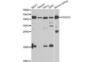 Western blot analysis of extracts of various cell lines, using PROCR antibody. (PROCR antibody)
