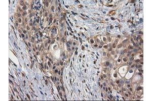 Image no. 3 for anti-Destrin (Actin Depolymerizing Factor) (DSTN) antibody (ABIN1497910) (Destrin antibody)