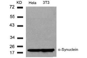 Image no. 2 for anti-Synuclein, alpha (SNCA) (Tyr136) antibody (ABIN319340) (SNCA antibody  (Tyr136))