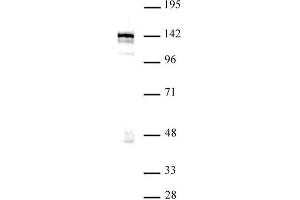 Western blot of BRD8 / SMAP2 antibody. (BRD8 antibody  (N-Term))