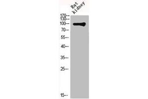 Western Blot analysis of RAT-KIDNEY cells using mGluR-4 Polyclonal Antibody (Metabotropic Glutamate Receptor 4 antibody  (C-Term))