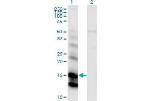 Western Blot analysis of CST6 expression in transfected 293T cell line by CST6 monoclonal antibody (M01), clone 2H8. (CST6 antibody  (AA 29-149))