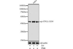 Western blot analysis of extracts of HeLa cells, using Phospho-STK11-S334 antibody (ABIN6135322, ABIN6136260, ABIN6136261 and ABIN6225618) at 1:1000 dilution. (LKB1 antibody  (pSer334))