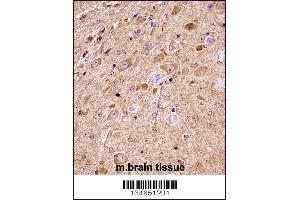 Mouse Nlk Antibody immunohistochemistry analysis in formalin fixed and paraffin embedded mouse brain tissue followed by peroxidase conjugation of the secondary antibody and DAB staining. (Nemo-Like Kinase antibody  (C-Term))