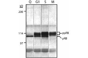 Cell cycle expression of retinoblastoma proteins (Rb) in MOLT-4 human leukemia cell line expressing Rb. (Retinoblastoma 1 antibody  (AA 332-344))