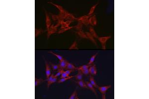 Immunofluorescence analysis of C6 cells using Parkin Rabbit pAb (ABIN6132295, ABIN6145226, ABIN6145227 and ABIN6215092) at dilution of 1:50 (40x lens). (Parkin antibody  (AA 1-300))