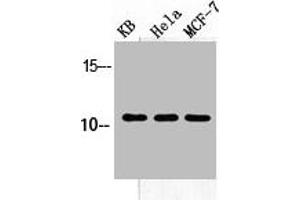 Western Blot analysis of KB HELA MCF-7 cells using SDF-1 Polyclonal Antibody (CXCL12 antibody  (C-Term))