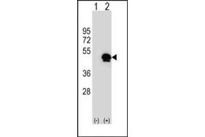 Western blot analysis of SERPINE1 (arrow) using SERPINE1 Antibody (Center) Cat.