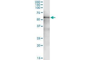 Immunoprecipitation of RP6-213H19. (STK26/MST4 antibody  (AA 1-416))