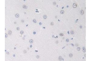 Detection of GDNF in Rat Cerebrum Tissue using Polyclonal Antibody to Glial Cell Line Derived Neurotrophic Factor (GDNF) (GDNF antibody  (AA 78-211))