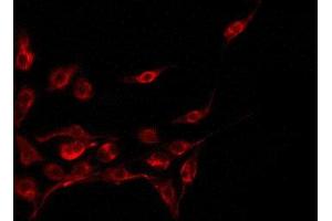 ABIN6275044 staining A549 by IF/ICC. (CST11 antibody  (Internal Region))