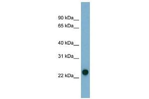 AK3 antibody used at 1 ug/ml to detect target protein. (Adenylate Kinase 3 antibody  (N-Term))