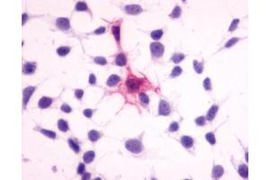 Anti-MC4 Receptor antibody immunocytochemistry (ICC) staining of HEK293 human embryonic kidney cells transfected with MC4 Receptor. (MC4R antibody  (N-Term))