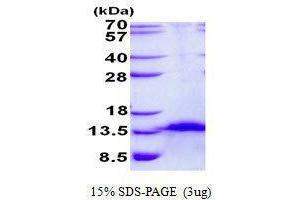 Figure annotation denotes ug of protein loaded and % gel used. (FDCSP Protein)