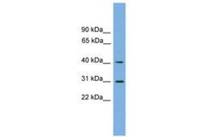 anti-Hydroxy-delta-5-Steroid Dehydrogenase, 3 beta- and Steroid delta-Isomerase 7 (HSD3B7) (AA 107-156) antibody