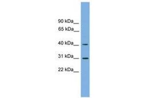 Image no. 1 for anti-Hydroxy-delta-5-Steroid Dehydrogenase, 3 beta- and Steroid delta-Isomerase 7 (HSD3B7) (AA 107-156) antibody (ABIN6744871) (HSD3B7 antibody  (AA 107-156))