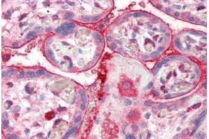 Human Placenta (formalin-fixed, paraffin-embedded) stained with CENTA2 antibody ABIN337009 at 5 ug/ml followed by biotinylated anti-goat IgG secondary antibody ABIN481715, alkaline phosphatase-streptavidin and chromogen. (ADAP2 antibody  (AA 375-387))