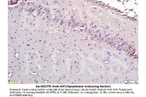 Immunohistochemistry (IHC) image for anti-Apoptosis-Inducing Factor, Mitochondrion-Associated, 1 (AIFM1) (AA 131-230) antibody (ABIN724010)