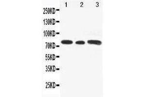 Anti-Gli3 antibody, Western blotting Lane 1: Rat Testis Tissue Lysate Lane 2: A549 Cell Lysate Lane 3: SW620 Cell Lysate (GLI3 antibody  (N-Term))
