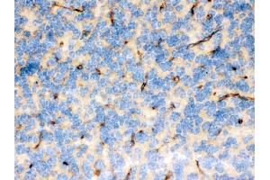 FCGRT was detected in paraffin-embedded sections of mouse brain tissues using rabbit anti- FCGRT Antigen Affinity purified polyclonal antibody at 1 μg/mL.