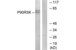 Western blot analysis of extracts from 3T3 cells, treated with PMA (125 ng/mL, 30 mins), using p90 RSK (Ab-573) antibody. (RPS6KA1 antibody  (Thr573))