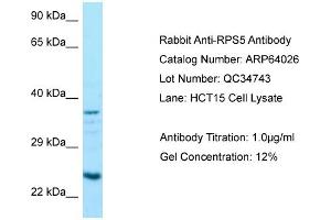 Western Blotting (WB) image for anti-Ribosomal Protein S5 (RPS5) (C-Term) antibody (ABIN971632) (RPS5 antibody  (C-Term))